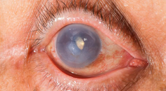 RMD Healthcare Image