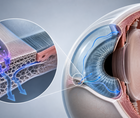 Cross section of eye trabecular meshwork showing glaucoma related aqueous outflow and intraocular pressure regulation