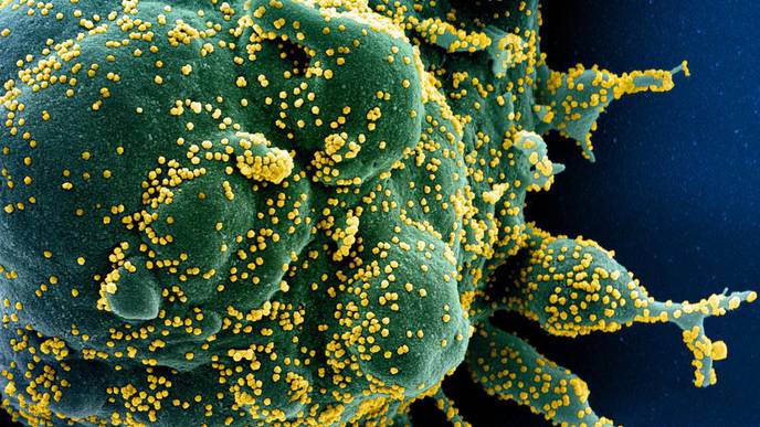 NIH Begins Large Clinical Trial to Test Immune Modulators for Treatment of COVID-19