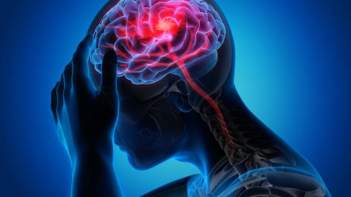 COVID-19 May Be Linked to Brain Complications, But Does It Cause Them?