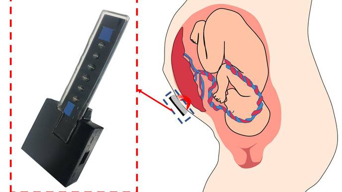 Diagnosing Pregnancy Complications by Monitoring Placental Oxygen