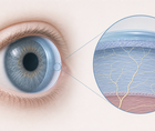 persistent ocular symptoms after covid 19 point to neuroinflammation
