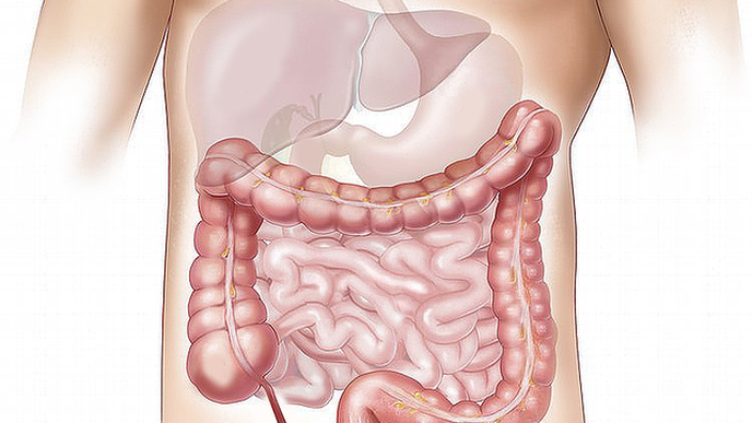 Increasing Global Rates of Liver Cancer Uncovered