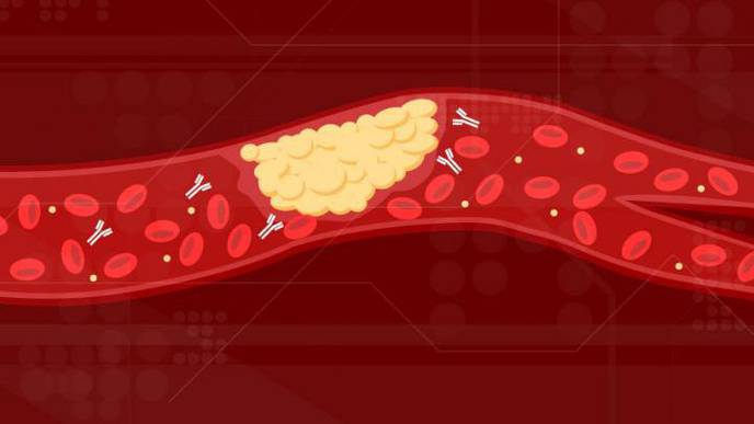 Scientists Identified the Cause of COVID-19 Blood Clots