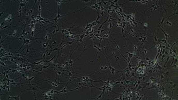 Study Identifies Group of Genes with Altered Expression in Autism