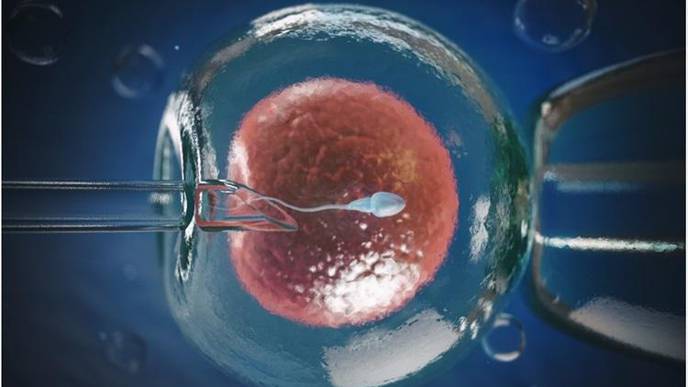 Accurate 3D Imaging of Sperm Cells Moving at Top Speed Could Improve IVF Treatments