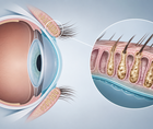 technology based dry eye interventions rank differently by outcome