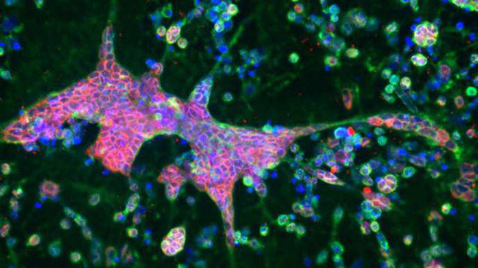 3D Brain-Like Tissue Model Links Alzheimer’s Disease with Herpes