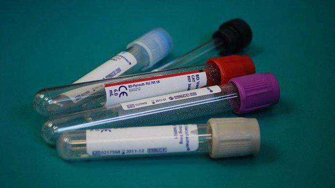 A New Antiviral Drug Heading into Clinical Trials Offers Hope for COVID-19 Treatment