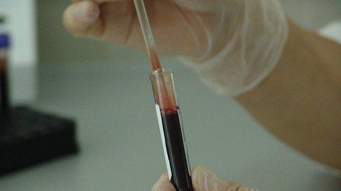 Study Reveals Factors Influencing Outcomes in Kidney Cancer Treated With Immunotherapy