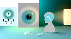 Long Term Impact of Bifocal Contact Lenses in Controlling Myopia in Children