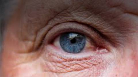 Genetic Risk Factors of Age-Related Macular Degeneration (AMD)