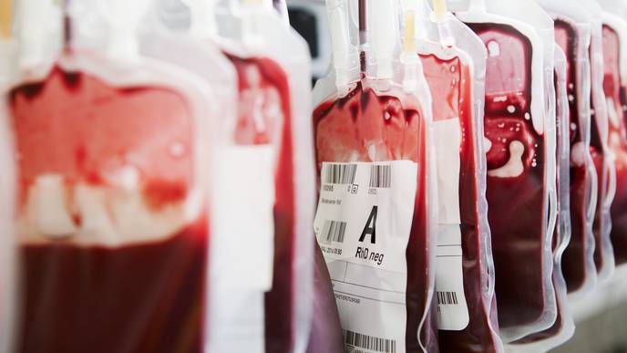 Blood Types May Play Role In COVID-19 Severity