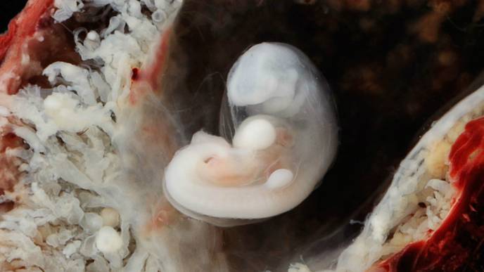 Researchers Produce Model of Early Embryonic Brain
