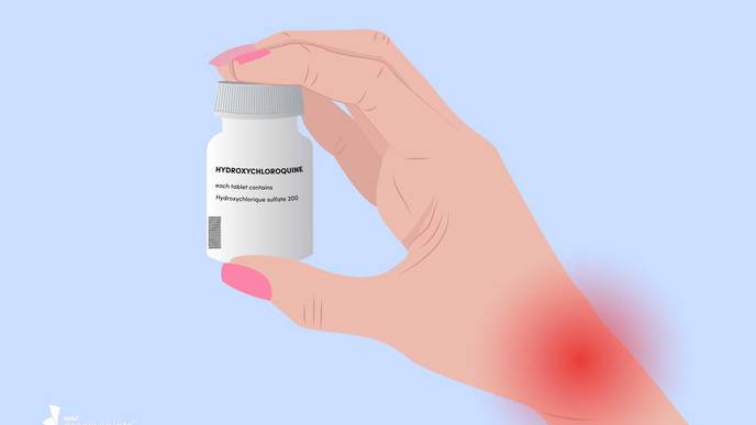 New Method to Measure Levels of Hydroxychloroquine in Patients with SLE