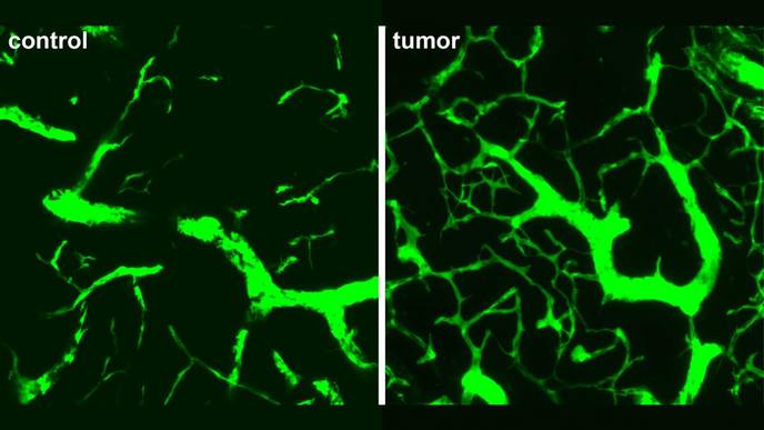 Researchers Observe Early Stages of Blood Vessel Development in Lymph Node Tumors