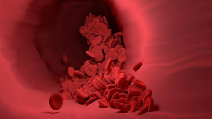 Reducing Need for Blood Transfusion During Heart Surgery Is Focus of New Practice Guideline