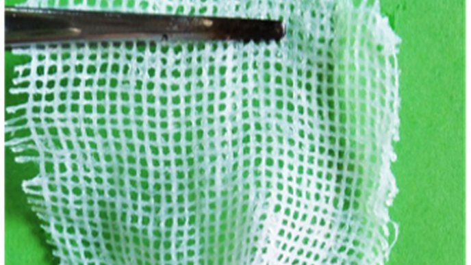 New Bandages Could Help to Treat Diabetic & Burn Wounds