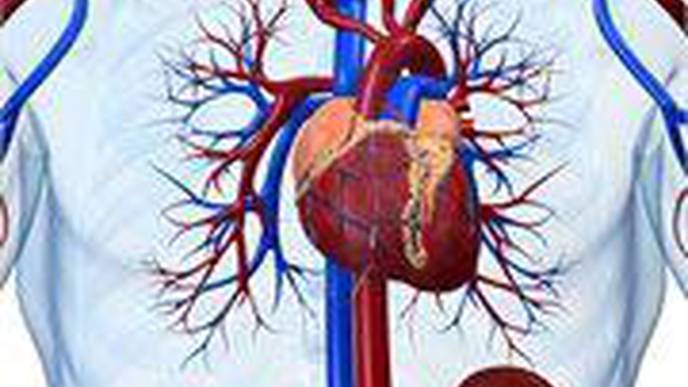 Black Patients Fare Worse After Angioplasty