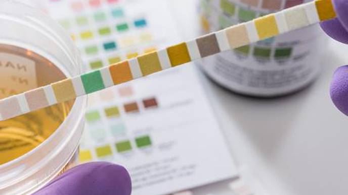 Unusual Immune Response in Bladder Appears to Drive Repeat UTIs