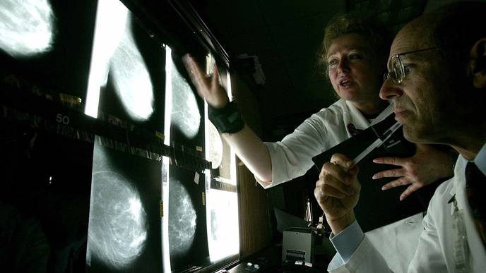 How Coronavirus Has Changed Cancer Screening & Care