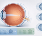 lamp eight year data on tapering low concentration atropine