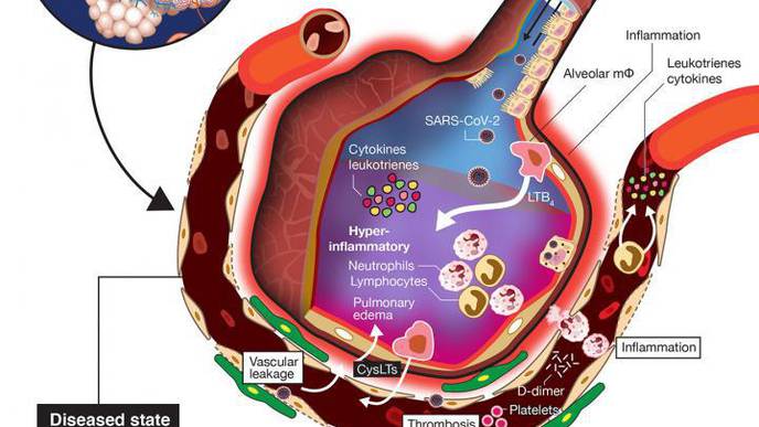 Novateur Ventures Explores New Strategy to Reduce Hyperinflammatory Response Caused by COVID-19