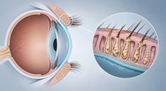 technology based dry eye interventions rank differently by outcome